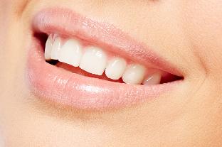 Blanchiment et facettes dentaires Centre dentaire Herblay Conflans